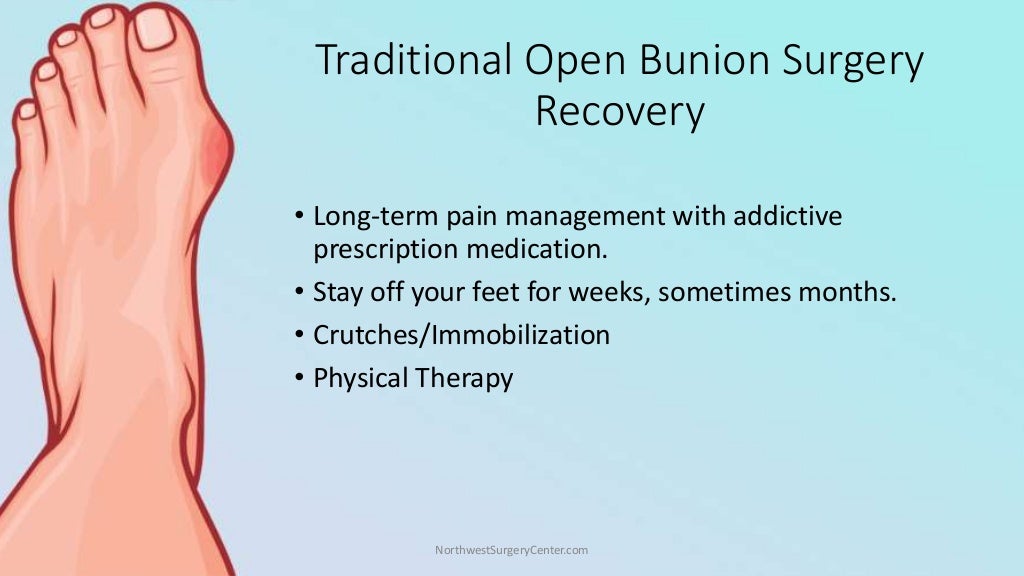 Minimally Invasive Bunion Removal Surgery