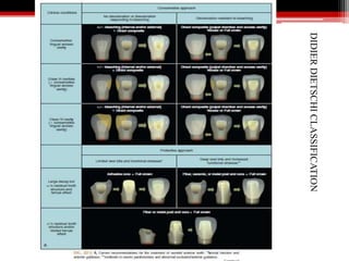 DIDIERDIETSCHICLASSIFICATION
 