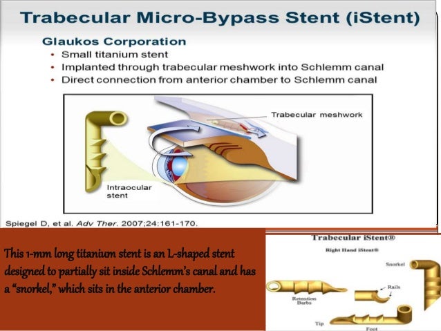 Minimally invasive surgery