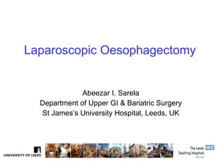 Laparoscopic Oesophagectomy Abeezar I. Sarela Department of Upper GI & Bariatric Surgery St James’s University Hospital, Leeds, UK 