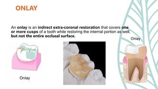 Minimally Invasive Prosthodontics Restoration | PPTX