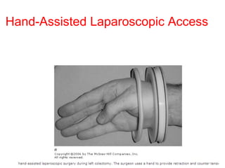 Hand-Assisted Laparoscopic Access 
 