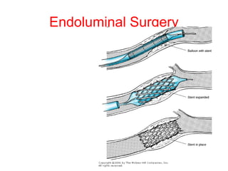 Endoluminal Surgery 
 