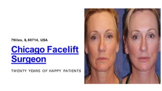 7Niles, IL 60714, USA
Chicago Facelift
Surgeon
TW ENTY YEARS OF HAPPY PATIENTS
 