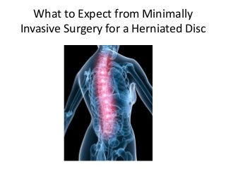 What to Expect from Minimally
Invasive Surgery for a Herniated Disc
 