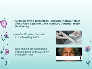 Minimal Visit Complete Denture | PPTX