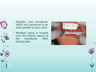 Occlusal Plane Orientation, Maxillary Anterior Mold
and Shade Selection, and Maxillary Anterior Tooth
Positioning
• AvaDe...