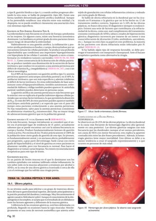 miniMANUAL 1 CTO

o tipo B, gastritis fúndica o tipo A, y cuando ambos progresan afec-       tejido de granulación con células inﬂamatorias crónicas y rodeado
tando la otra zona, se habla de pangastritis (tipo AB). Existe una         por cierto grado de ﬁbrosis.
forma también denominada gastritis atróﬁca multifocal. Aunque                  Se habla de úlcera refractaria en la duodenal que no ha cica-
se ha pretendido establecer una relación entre esta entidad y la           trizado en 8 semanas o la gástrica que no lo ha hecho en 12 de
dispepsia, no se puede establecer claramente una asociación clara          tratamiento médico correcto. Suponen un 5-10% de las úlceras
con síntomas especíﬁcos.                                                   pépticas, en franco descenso. El diagnóstico siempre es endoscó-
                                                                           pico. Existen una serie de factores que contribuyen a la refracta-
GASTRITIS DE TIPO INMUNE. GASTRITIS TIPO A.                                riedad de la úlcera, como son: mal cumplimiento del tratamiento;
La enfermedad es más frecuente en el norte de Europa y predomina           consumo continuado de AINEs; tabaco; estados de hipersecreción
en las mujeres. En algunos casos, existe una herencia autosómica           gástrica; diagnóstico incorrecto por tratarse de un tumor o una
dominante. Los familiares en primer grado de estos pacientes tienen        causa infrecuente de úlceración (Crohn, amiloidosis, sarcoidosis,
mayor riesgo de desarrollar la enfermedad.                                 etc.). Aunque no está claro su papel en este problema, la mayoría
     Habitualmente es una gastritis atróﬁca. La inﬂamación y pos-          de los pacientes con úlcera refractaria están infectados por H.
terior atroﬁa predomina en fundus y cuerpo, destruyéndose por un           pylori (MIR 00-01, 4).
mecanismo inmune las células parietales. Se produce una profunda               Si ha habido algún tipo de respuesta favorable, se debe pro-
hipoclorhidria que condiciona una importante hipergastrinemia              rrogar el tratamiento con omeprazol o lansoprazol. Ante el fracaso
con hiperplasia de las células G antrales, llegando a veces a trans-       terapéutico quedaría como alternativa la cirugía.
formarse en verdaderos tumores carcinoides (MIR 95-96, 66; MIR
00-01, 2). Como consecuencia de la destrucción de células parieta-
les, se produce también una disminución de la secreción de factor
intrínseco, que conduce en ocasiones a una anemia perniciosa por
déﬁcit de vitamina B12 (megaloblástica) (MIR 03-04, 187), con o sin
clínica neurológica.
     En el 90% de los pacientes con gastritis atróﬁca tipo A y anemia
perniciosa aparecen anticuerpos anticélula parietal y en el 40% Ac
antifactor intrínseco, que son más especíﬁcos y además colaboran
al déﬁcit de factor intrínseco. En otras enfermedades de base auto-
inmune como el hipoparatiroidismo, tiroiditis autoinmune, enfer-
medad de Addison y vitíligo también pueden aparecer Ac anticélula
parietal; también pueden detectarse en personas sanas.
     La gastritis atróﬁca sin anemia perniciosa es más frecuente que
la anterior; esto se explicaría al quedar indemnes algunas células pa-
rietales que secretan factor intrínseco, lo que permitiría la absorción
de B12. En más del 50% de estos pacientes pueden aparecer también
anticuerpos anticélula parietal y se especula que con el paso del
tiempo estos pacientes evolucionarán a una anemia perniciosa.
No hay tratamiento, salvo para la anemia perniciosa (consistente
en administrar vitamina B12 intramuscular). Hay un mayor riesgo            Figura 17. Ulcus: borde eritematoso y fondo fibrinoso.
de adenocarcinoma gástrico que en la población general.
                                                                           COMPLICACIONES DE LA ÚLCERA PÉPTICA.
GASTRITIS ASOCIADA A H. PYLORI. GASTRITIS TIPO B (MIR 00-01F, 3).          HEMORRAGIA.
Es la más frecuente. Aunque inicialmente se consideró que el an-           Se observa en un 20-25% de las úlceras pépticas. La úlcera duodenal
tro era el principal lugar de residencia de H. pylori, actualmente         es la causa más frecuente de hemorragia digestiva alta (general-
sabemos que se puede encontrar casi con la misma frecuencia en             mente en cara posterior). Las úlceras gástricas sangran con más
cuerpo y fundus. Produce fundamentalmente lesiones de gastritis            frecuencia que las duodenales (aunque al ser menos prevalentes,
crónica activa. Por encima de los 70 años prácticamente el 100% de         son causa de HDA con menor frecuencia; esto explica la aparente
la población tiene cierto grado de gastritis de este tipo. En jóvenes,     contradicción entre las dos frases precedentes). Además, la hemo-
es fundamentalmente antral, y en ancianos afecta, probablemente            rragia gástrica tiene mayor mortalidad. Esto último se debe a su
por progresión, a gran parte del estómago. Suele cursar con cierto         menor tendencia a cesar el sangrado espontáneamente y a que
grado de hipoclorhidria y el nivel de gastrina en estos pacientes es       ocurren en personas de más edad.
altamente variable, pero con frecuencia es normal. Para hacer el
diagnóstico se toman varias biopsias. No existen recomendaciones
terapéuticas para este tipo de lesión.

GASTROPATÍA REACTIVA.
Es un patrón de lesión mucosa en el que lo dominante son los
cambios epiteliales con mínimo inﬁltrado celular inﬂamatorio. Se
ven sobre todo en la mucosa adyacente a erosiones por alcohol o
AINEs, en la zona de una úlcera gástrica cicatrizada o cerca de ella
y en el estómago que ha sufrido una cirugía previa.


TEMA 16. ÚLCERA PÉPTICA Y POR AINES.

16.1. Úlcera péptica.

Es un término usado para referirse a un grupo de trastornos úlcera-
tivos del tracto gastrointestinal superior, afectando principalmente a
la porción proximal del duodeno y estómago. Muy frecuentemente el
agente causal es Helicobacter pylori. Aunque el conocimiento de la etio-
patogenia es incompleto, se acepta que es el resultado de un disbalance
entre los factores agresores y defensores de la mucosa gástrica.
    A diferencia de las erosiones gástricas, está bien delimitada y es
profunda, llegando en ocasiones hasta la capa muscular. Histoló-           Figura 18. Hemorragia por úlcera péptica. Se observa vaso sangrando
gicamente es una zona de necrosis eosinofílica que asienta sobre                      activamente.

Pág. 30
 