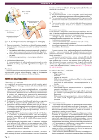 miniMANUAL 1 CTO

                                                                          Lo más novedoso: modulación de la reparación de las heridas con
                                                                          factores de crecimiento.

                                                                          TIPO DE CICATRIZACIÓN.
                                                                          1) Por primera intención. Ocurre en aquellas heridas limpias en
                                                                              las que se produce una aproximación inmediata con sutura.
                                                                          2) Por segunda intención. Hay una cicatrización espontánea. La
                                                                              epitelización se extiende unos milímetros sobre la herida abier-
                                                                              ta.
                                                                          3) Por tercera intención (cierre primario diferido). Ocurre cuando
                                                                              una herida se cierra después de un período de cicatrización
                                                                              secundaria.

                                                                          TRATAMIENTO DE LAS HERIDAS.
                                                                          Cierre primario o por primera intención. Sutura inmediata de la he-
                                                                          rida. En heridas con mínima contaminación bacteriana, hemorragia
                                                                          controlable y sin tejido necrótico ni cuerpos extraños.
                                                                              Cierre por segunda intención. No se sutura la herida y se deja
                                                                          que cicatrice espontáneamente. Está indicado en:
                                                                          • Heridas muy contaminadas.
Figura 40. Duodenopancreatectomía cefálica (operación de Whipple).        • Cuando el tratamiento se ha demorado más de 6-8 horas.
                                                                          • Cuando hay trayectos muy irregulares.
2) Tumores irresecables. Cuando hay metástasis hepáticas, ganglio-        • Mordeduras humanas y de animales con tratamiento antibiótico
   nares, implantes peritoneales o invasión vascular, el tratamiento          (Amoxicilina-clavulánico).
   es paliativo.
   • Derivaciones quirúrgicas. Hepaticoyeyunostomía (evita la icte-           En estos casos se debe realizar desbridamiento eliminando
       ricia) y gastroyeyunostomía (evita la obstrucción digestiva).      esfacelos y cuerpos extraños y, si procede, drenaje de colecciones
   • Inﬁltración de nervios esplácnicos con alcohol 95%: alivio           purulentas. Se añade al tratamiento quirúrgico, antibióticos y pro-
       del dolor.                                                         ﬁlaxis antitetánica.
   • Endoprótesis percutáneas o endoscópicas paliativas.                      Cierre por tercera intención o sutura primaria diferida. En
                                                                          heridas que no se suturan inmediatamente por el riesgo de infec-
3) Tratamiento coadyuvante.                                               ción, dejando que cicatricen por segunda intención durante 4-5
   El empleo conjunto de radioterapia y quimioterapia permite             dias. Si tras este tiempo se considera que el riesgo de infección ha
   disminuir el dolor y mejorar la supervivencia en algunos pa-           disminuido, se procede a una escisión o Friedrich (extirpación de
   cientes.                                                               2 mm o más de borde cutáneo) y sutura (MIR 00-01, 17; MIR 96-97,
                                                                          92; MIR 95-96, 259).
PRONÓSTICO.
La mayoría fallecen antes del año, y sólo un 10-20% de los resecados      FACTORES QUE AFECTAN LA CICATRIZACIÓN.
(con intención curativa) sobreviven a los 5 años. De forma global         1) Factores locales.
sobreviven el 0,5% de los enfermos al cabo de 10 años.                       - Riego sanguíneo.
                                                                             - Infección.
                                                                             - Tamaño de la herida.
TEMA 32. CICATRIZACIÓN.                                                      - Mala técnica: suturas a tensión, movilidad excesiva, espacios
                                                                                 muertos, restos necróticos.
FISIOLOGÍA DE LA CICATRIZACIÓN.                                              - Aplicación de medicamentos y sustancias químicas en la
La reparación de las heridas presenta una serie de cambios quími-                herida.
cos, morfológicos y físicos que resultan en la formación del tejido       2) Factores generales.
cicatricial.                                                                 - Edad, estado nutritivo, déﬁcit de vitaminas (C, A) y oligoele-
1) Fase inﬂamatoria. Es la respuesta inicial a la lesión. La intensidad          mentos (cobre, hierro, zinc).
    y duración están relacionados con el grado de contaminación              - Corticoides, citotóxicos (la quimioterapia debería retrasarse
    y daño tisular. Después de una vasoconstricción transitoria                  por lo menos 4-7 dias después de la operación), radiaciones
    se produce una vasodilatación, aumento de la permeabilidad                   ionizantes.
    capilar y migración de células inﬂamatorias. Esta respuesta in-          - Diabetes (mayor riesgo en pacientes mal controlados), sep-
    ﬂamatoria está mediada por la liberación de cininas, histamina               sis, uremia, shock, neoplasias preexistentes, insuﬁciencia
    y prostaglandinas.                                                           hepática.
2) Epitelización. Comienza a las 24 horas de la lesión con migración
    de células de la capa basal de la epidermis hacia la herida.          CICATRIZACIÓN PATOLÓGICA.
3) Fase celular o de neoformación vascular. Inicio a las 48-72 horas.     • Cicatriz hipertróﬁca. Surge por un desarrollo excesivo de mioﬁ-
    Células mesenquimales pluripotenciales de alrededor de los               broblastos, lo cual conlleva una tendencia a la retracción y tiene
    vasos migran hacia la herida y se transforman en ﬁbroblastos.            importantes repercusiones funcionales. Suele diferenciarse
    Factores liberados por plaquetas y macrófagos inducen la                 del queloide en que no sobrepasa los límites de la cicatriz. El
    neovascularización.                                                      tratamiento consiste en una Z-plastia.
4) Fase proliferativa y de síntesis de colágeno. Desde el 5º dia has-     • Queloide. Cicatriz exuberante por exceso de colágeno, que rebasa
    ta la 3ª semana se produce una síntesis activa de colágeno y             los límites de la piel sana. Se considera un tumor benigno. Son
    sustancia fundamental (proteoglucanos). Ocurre contracción               más frecuentes en región preesternal y espalda y en sujetos de raza
    de la herida por el desarrollo de mioﬁbroblastos a partir de los         negra. Dada su gran tendencia a la recidiva tras cirugía, se intentan
    ﬁbroblastos.                                                             tratamientos conservadores mediante inﬁltración intralesional de
5) Fase de remodelado. Predomina tras la 2ª-3ª semana. Equilibrio            triamcinolona, presoterapia, láminas de silicona, colchicina oral,
    entre la formación de colágeno y su destrucción por la actividad         etc. Si la respuesta no es satisfactoria, se puede realizar extirpación
    de la colagenasa. Hay un incremento progresivo de la fuerza y            en bloque, aunque el riesgo de recidiva es alto.
    resistencia de la cicatriz, aunque nunca llegará a alcanzar la        • Cicatriz dolorosa. Dolor debido a la formación de neuromas. Se
    capacidad del tejido no lesionado.                                       tratan con inﬁltración de anestésicos locales y si no se resuelve,
                                                                             se puede practicar una simpatectomía.
   Todos estos procesos se ven inﬂuidos en duración y secuencia           • Úlceras cicatrizales rebeldes. Cuando la proliferación del tejido co-
por la salud del paciente, estado nutricional e intervención médica.         nectivo estrangula la formación de yemas vasculares, produciendo

Pág. 58
 