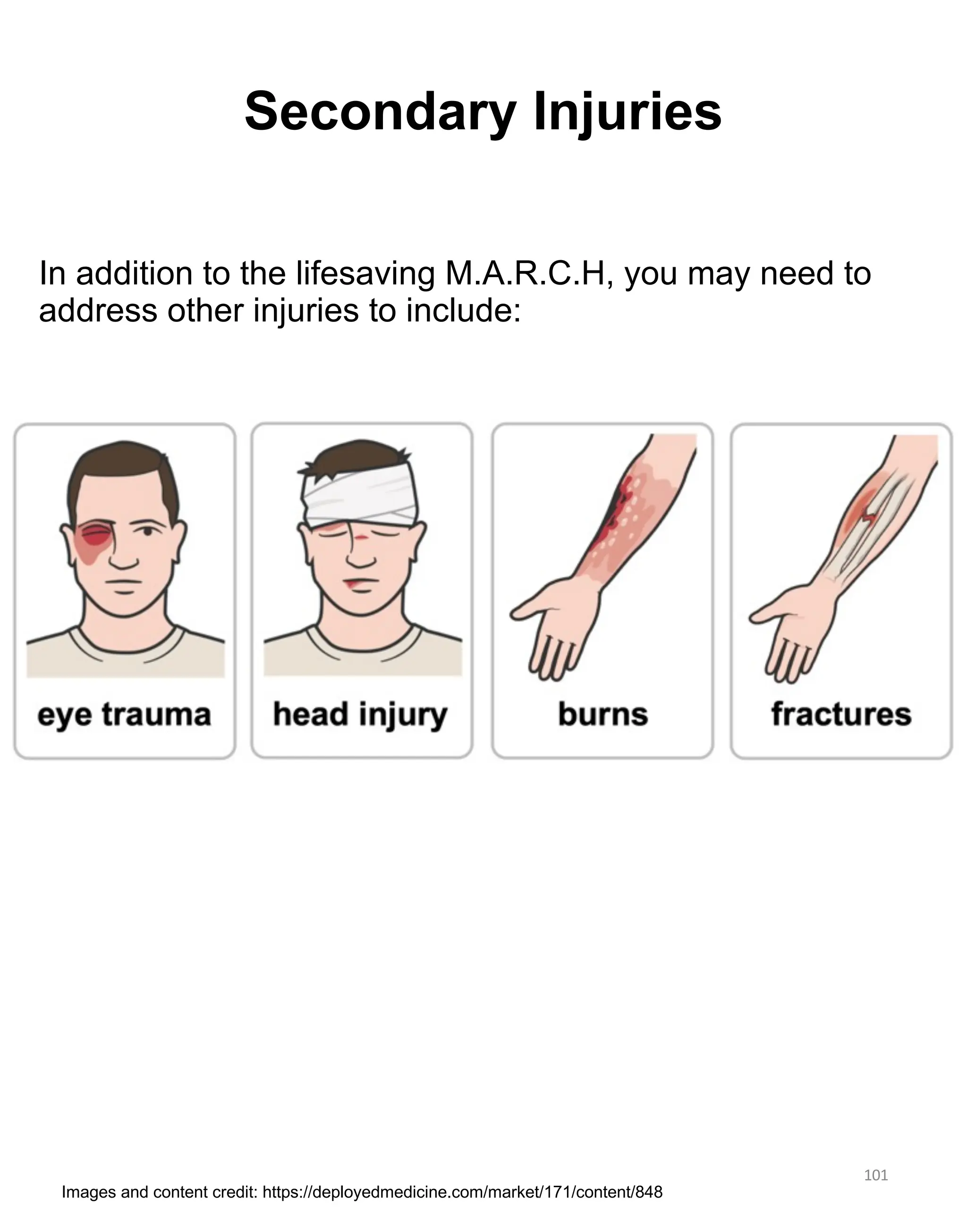 101
Secondary Injuries
In addition to the lifesaving M.A.R.C.H, you may need to
address other injuries to include:
Images and content credit: https://deployedmedicine.com/market/171/content/848
 