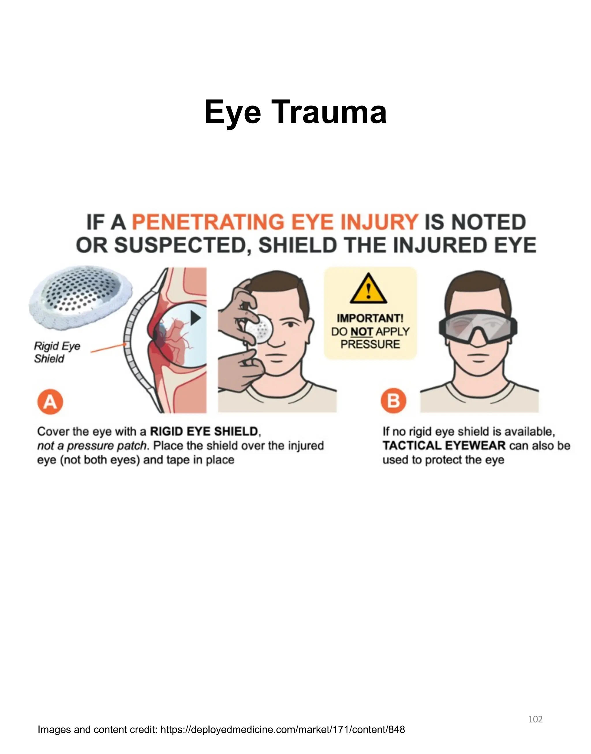 Eye Trauma
102
Images and content credit: https://deployedmedicine.com/market/171/content/848
 