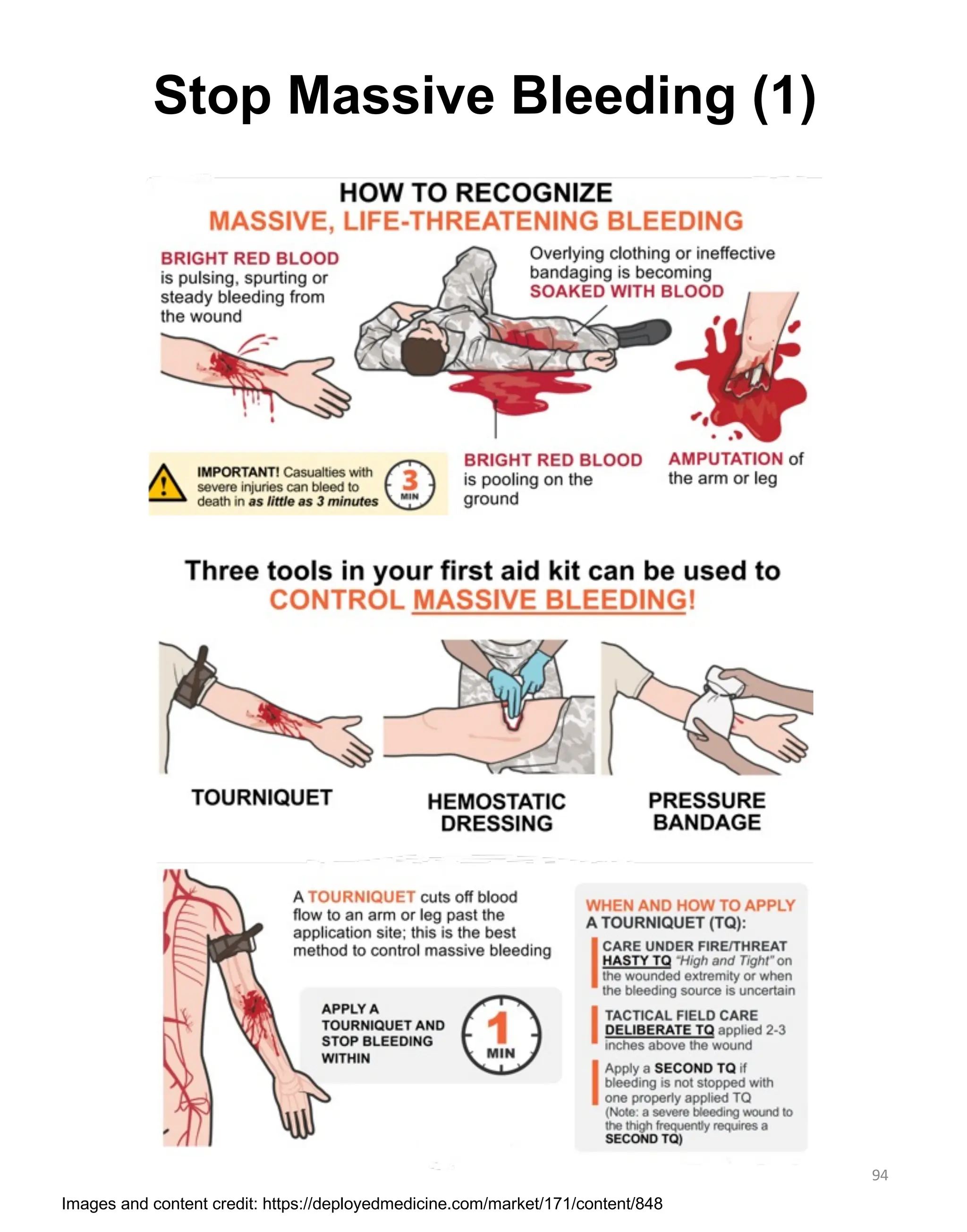 Stop Massive Bleeding (1)
94
Images and content credit: https://deployedmedicine.com/market/171/content/848
 