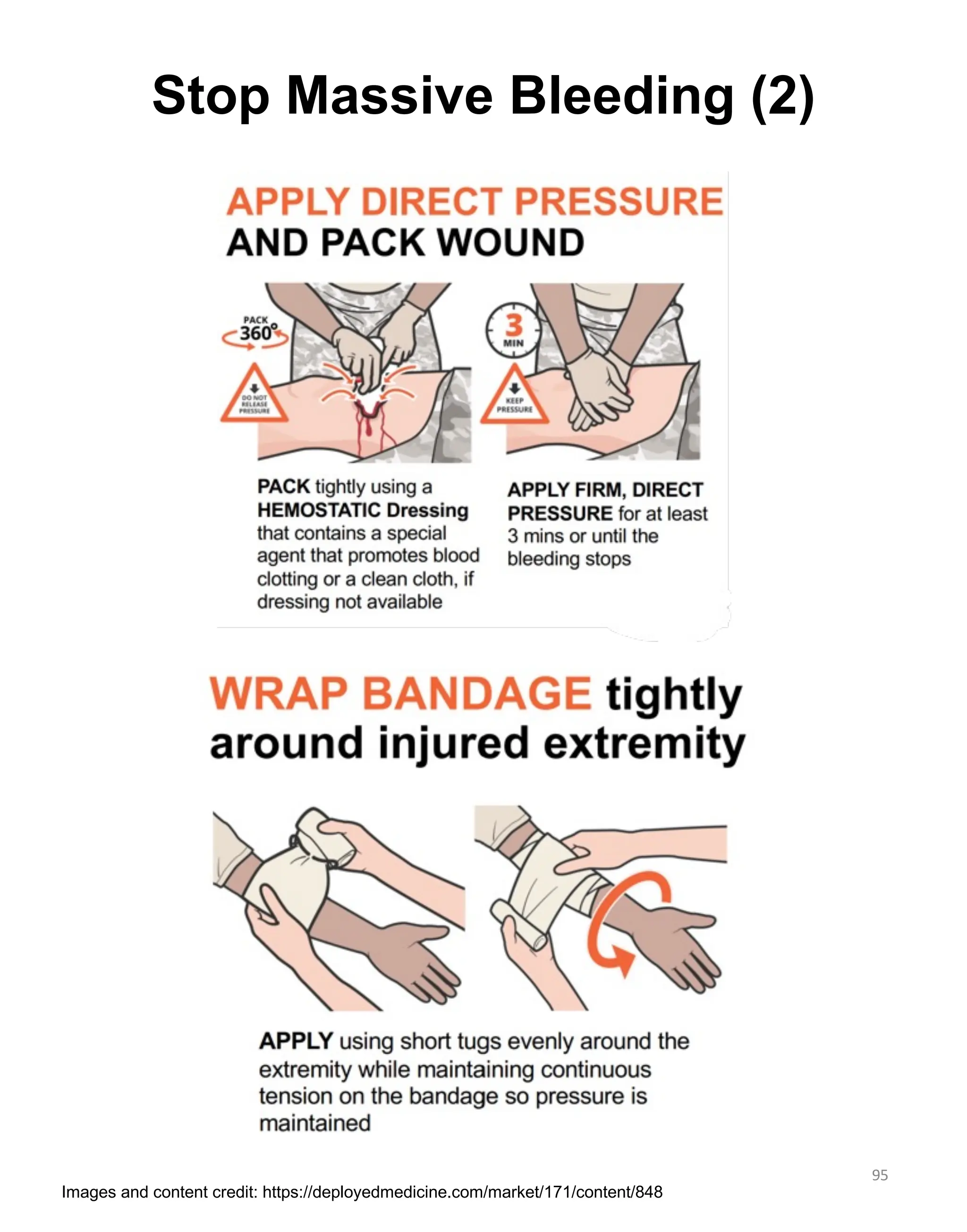 Stop Massive Bleeding (2)
95
Images and content credit: https://deployedmedicine.com/market/171/content/848
 