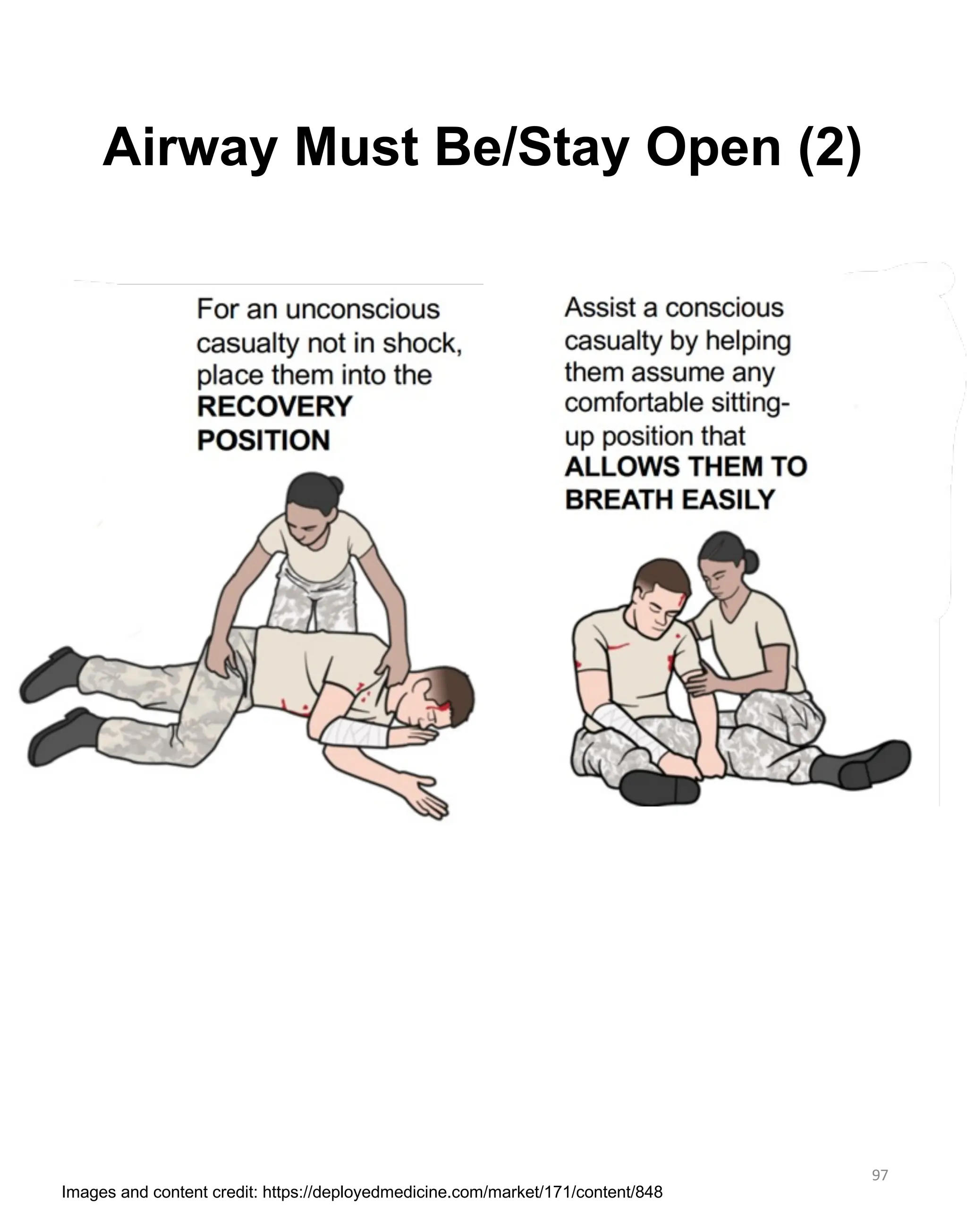 97
Airway Must Be/Stay Open (2)
Images and content credit: https://deployedmedicine.com/market/171/content/848
 
