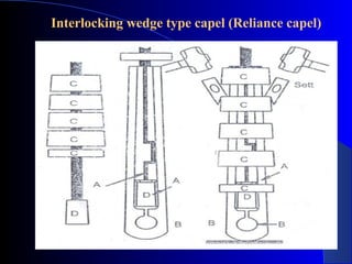Interlocking wedge type capel (Reliance capel)
 