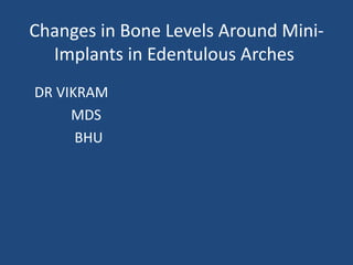 Changes in Bone Levels Around Mini-
Implants in Edentulous Arches
DR VIKRAM
MDS
BHU
 