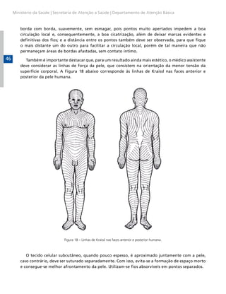Ministério da Saúde | Secretaria de Atenção a Saúde | Departamento de Atenção Básica



         borda com borda, suavemente, sem esmagar, pois pontos muito apertados impedem a boa
         circulação local e, consequentemente, a boa cicatrização, além de deixar marcas evidentes e
         definitivas dos fios; e a distância entre os pontos também deve ser observada, para que fique
         o mais distante um do outro para facilitar a circulação local, porém de tal maneira que não
         permaneçam áreas de bordas afastadas, sem contato íntimo.
46          Também é importante destacar que, para um resultado ainda mais estético, o médico assistente
         deve considerar as linhas de força da pele, que consistem na orientação da menor tensão da
         superfície corporal. A Figura 18 abaixo corresponde às linhas de Kraissl nas faces anterior e
         posterior da pele humana.




                               Figura 18 – Linhas de Kraissl nas faces anterior e posterior humana.



            O tecido celular subcutâneo, quando pouco espesso, é aproximado juntamente com a pele,
         caso contrário, deve ser suturado separadamente. Com isso, evita-se a formação de espaço morto
         e consegue-se melhor afrontamento da pele. Utilizam-se fios absorvíveis em pontos separados.
 