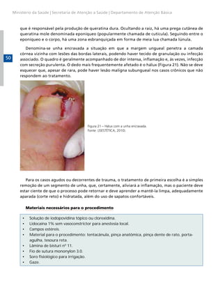 Ministério da Saúde | Secretaria de Atenção a Saúde | Departamento de Atenção Básica



         que é responsável pela produção de queratina dura. Ocultando a raiz, há uma prega cutânea de
         queratina mole denominada eponíqueo (popularmente chamada de cutícula). Seguindo entre o
         eponíqueo e o corpo, há uma zona esbranquiçada em forma de meia lua chamada lúnula.

            Denomina-se unha encravada a situação em que a margem ungueal penetra a camada
         córnea vizinha com lesões das bordas laterais, podendo haver tecido de granulação ou infecção
50       associado. O quadro é geralmente acompanhado de dor intensa, inflamação e, às vezes, infecção
         com secreção purulenta. O dedo mais frequentemente afetado é o hálux (Figura 21). Não se deve
         esquecer que, apesar de rara, pode haver lesão maligna subungueal nos casos crônicos que não
         respondem ao tratamento.




                                             Figura 21 – Hálux com a unha encravada.
                                             Fonte: (JSESTÉTICA, 2010).




            Para os casos agudos ou decorrentes de trauma, o tratamento de primeira escolha é a simples
         remoção de um segmento de unha, que, certamente, aliviará a inflamação, mas o paciente deve
         estar ciente de que o processo pode retornar e deve aprender a mantê-la limpa, adequadamente
         aparada (corte reto) e hidratada, além do uso de sapatos confortáveis.

              Materiais necessários para o procedimento

          •    Solução de iodopovidina tópico ou clorexidina.
          •    Lidocaína 1% sem vasoconstrictor para anestesia local.
          •    Campos estéreis.
          •    Material para o procedimento: tentacânula, pinça anatômica, pinça dente de rato, porta-
               agulha, tesoura reta.
          •    Lâmina de bisturi nº 11.
          •    Fio de sutura mononylon 3.0.
          •    Soro fisiológico para irrigação.
          •    Gaze.
 