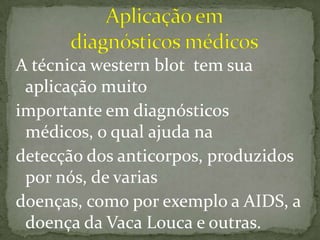 tecnica Western blot