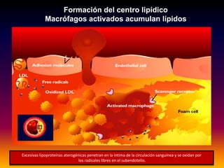 Formación del centro lipídico
Macrófagos activados acumulan lípidos
Excesivas lipoproteínas aterogénicas penetran en la íntima de la circulación sanguínea y se oxidan por
los radicales libres en el subendotelio.
 