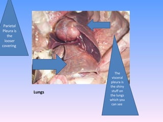 Lungs The visceral pleura is the shiny stuff on the lungs which you can see  Parietal Pleura is the looser covering  