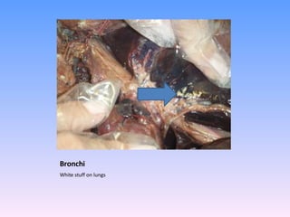 Bronchi  White stuff on lungs  
