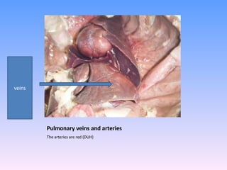 Pulmonary veins and arteries  The arteries are red (DUH) veins 