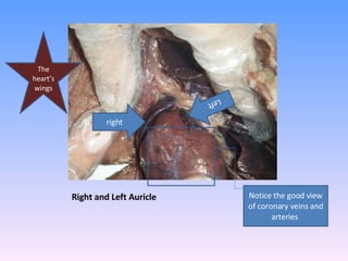 Right and Left Auricle  right Left  Notice the good view of coronary veins and arteries  The heart’s wings 