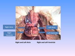 Right and Left Atria  Right and Left Ventricle Right Ventricle Right Atria Left Atria Left Ventricle 