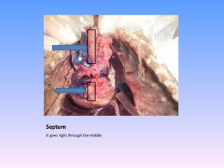 Septum It goes right through the middle 