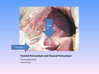 Parietal Pericardium and Visceral Pericardium Visceral-tight (shiny) Parietal-loose Parietal  Visceral   