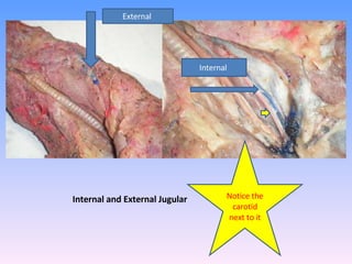 Internal and External Jugular  External  Internal  Notice the carotid next to it 