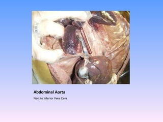 Abdominal Aorta Next to Inferior Vena Cava 