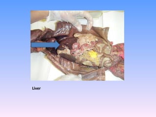 Liver 