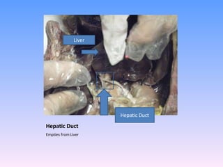 Hepatic Duct Empties from Liver  Liver Hepatic Duct 