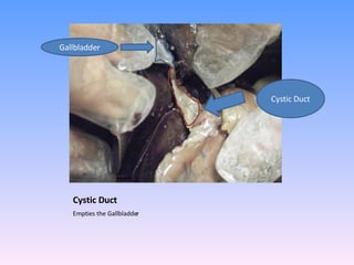 Cystic Duct Empties the Gallbladder  Gallbladder Cystic Duct 