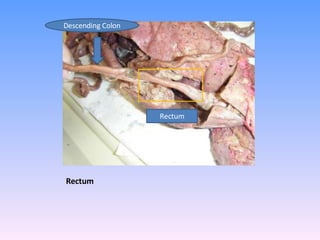 Rectum  Rectum Descending Colon 
