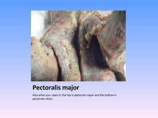 Pectoralis major Also when you  open it, the top is pectoralis major and the bottom is pectoralis minor 