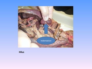 Hilus Indentation 