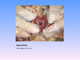 Renal Pelvis White region, innermost  