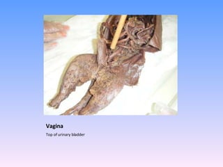 Vagina Top of urinary bladder 