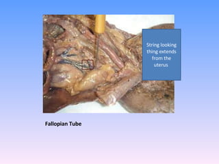 Fallopian Tube String looking thing extends from the uterus  