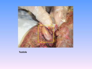 Testicle 