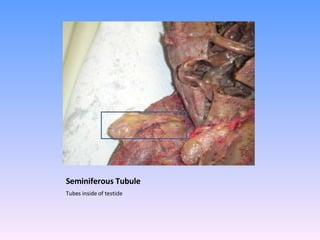 Seminiferous Tubule Tubes inside of testicle 