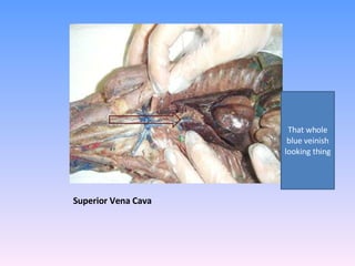 Superior Vena Cava  That whole blue veinish looking thing 