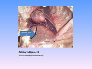 Falciform Ligament Membrane between lobes of Liver Under that   