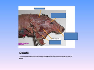 Masseter Somehow some of my pictures got deleted and the masseter was one of them 