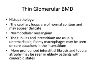 Thin Glomerular BMD Histopathology:  The capillary loops are of normal contour and may appear delicate Normocellular mesangium The tubules and interstitium are usually unremarkable; foamy macrophages may be seen on rare occasions in the interstitium More pronounced interstitial fibrosis and tubular atrophy may be seen in elderly patients with comorbid states 