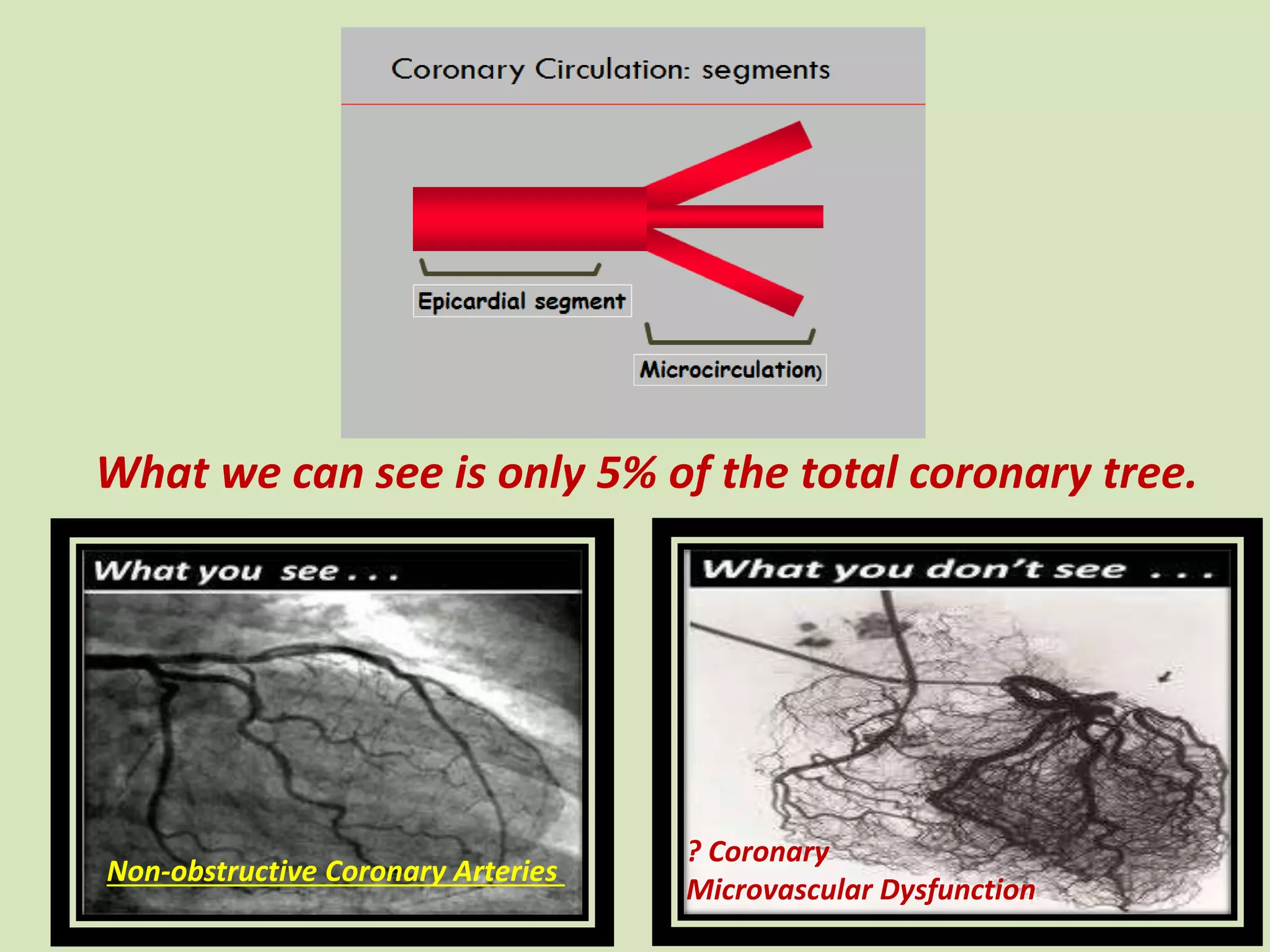 What we can see is only 5% of the total coronary tree.
? Coronary
Microvascular Dysfunction
Non-obstructive Coronary Arteries
 