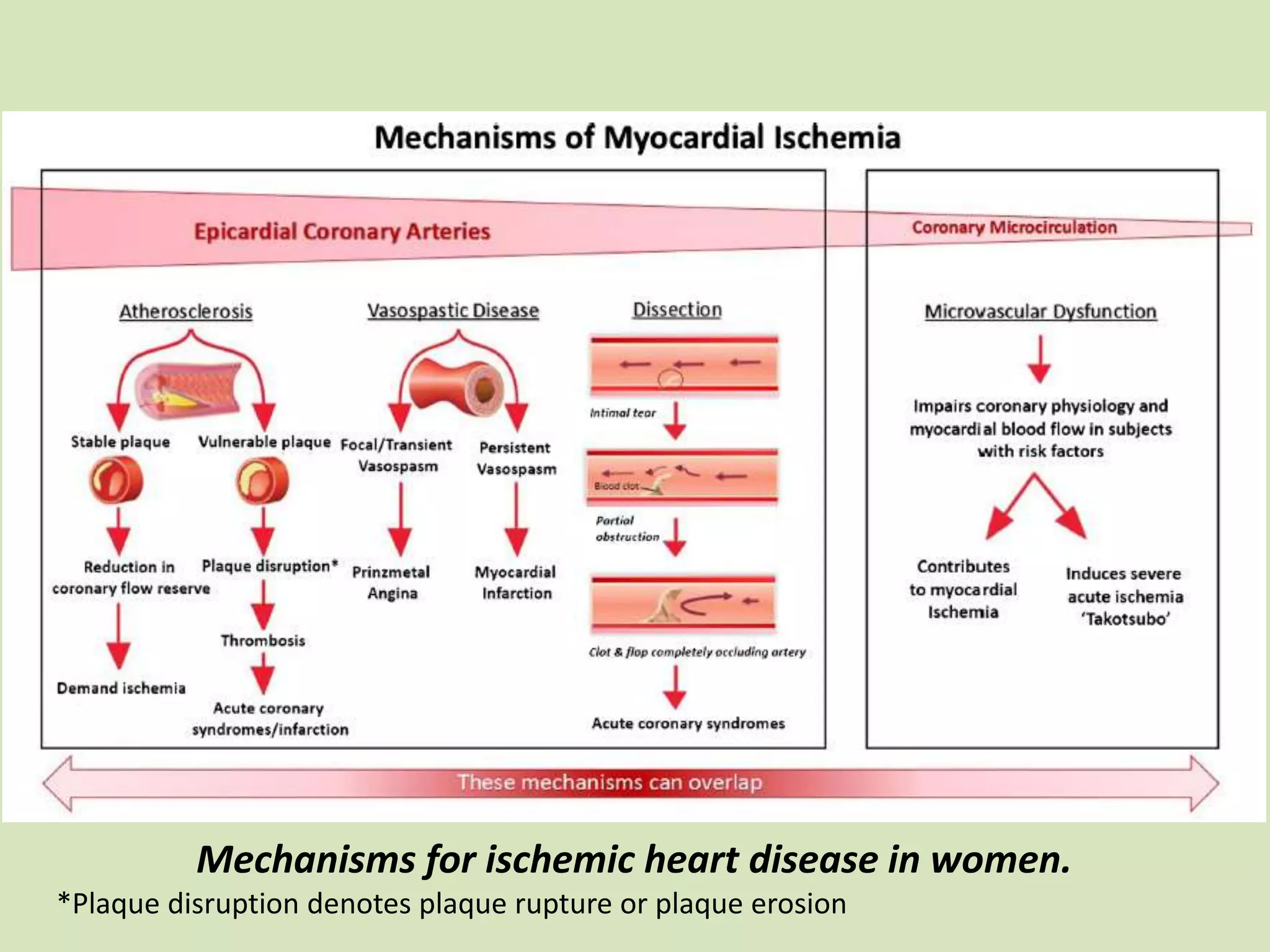 Mechanisms for ischemic heart disease in women.
*Plaque disruption denotes plaque rupture or plaque erosion
 